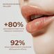 Набір проти сухості та для об&rsquo;єму губ Hillary Lip Hydration & Plumping Set K-11-944 фото 2