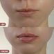 Набір проти сухості та для об&rsquo;єму губ Hillary Lip Hydration & Plumping Set K-11-944 фото 4
