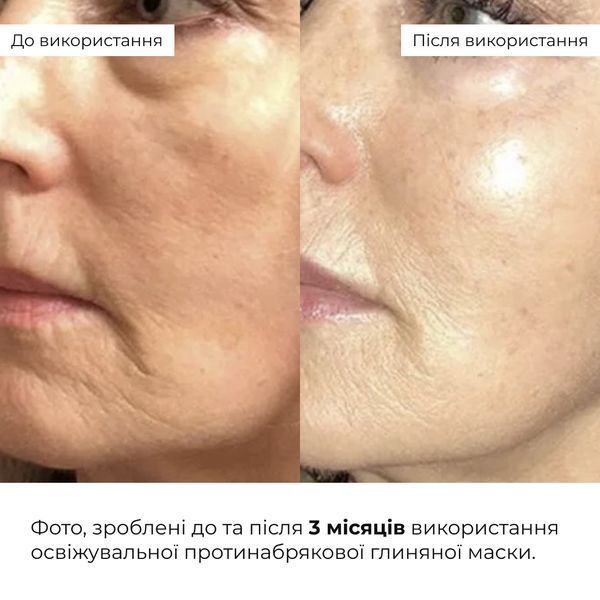Набір для миттєвого відновлення та зменшення набряків Hillary Instant Freshness & Puffiness Relief Kit K-11-717 фото